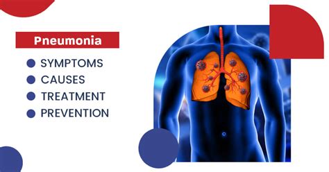 pulmonia and pneumonia|Pneumonia: Causes, Symptoms, Diagnosis & Treatment .